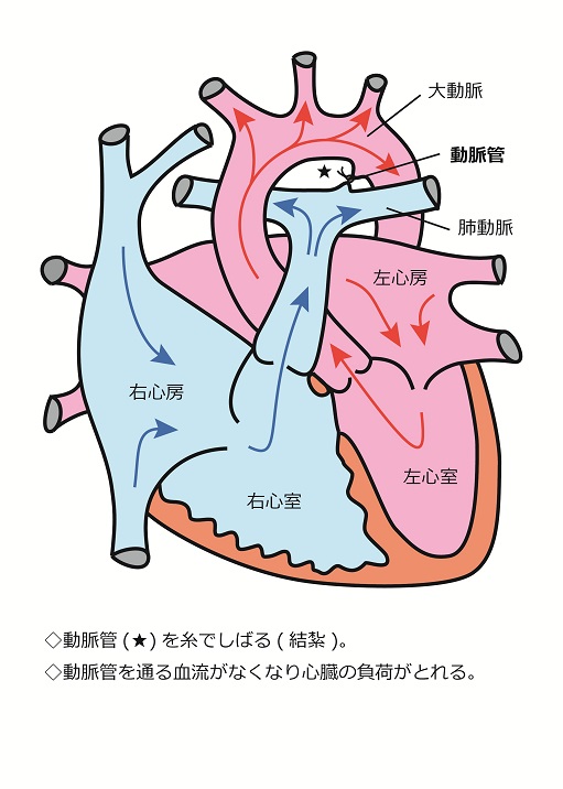 心臓シェーマ