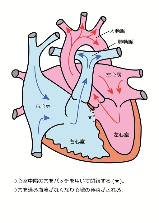 心臓シェーマ