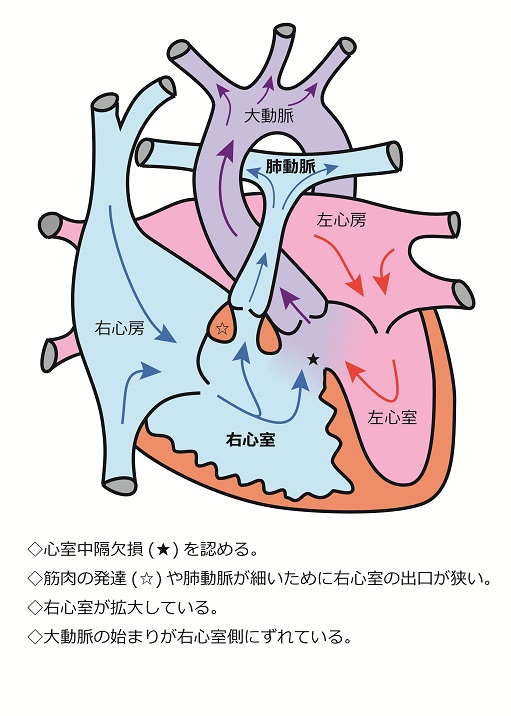 心臓シェーマ