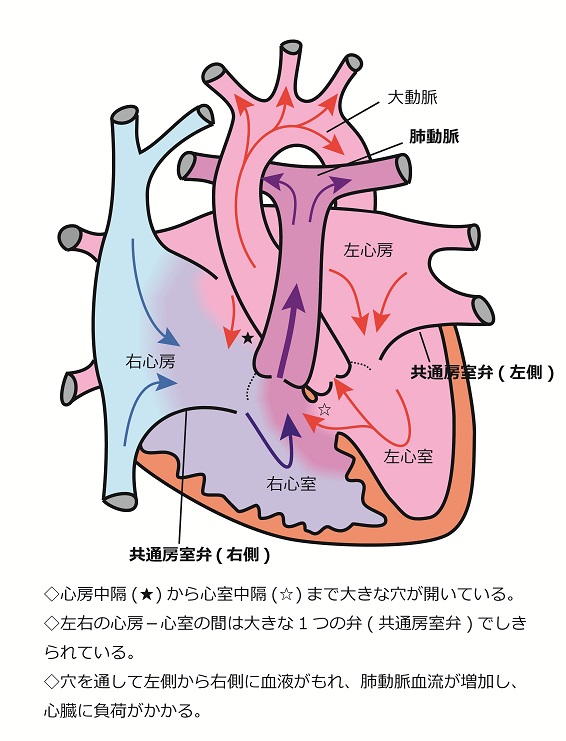 心臓シェーマ