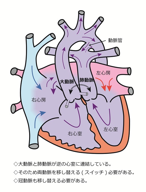 心臓シェーマ