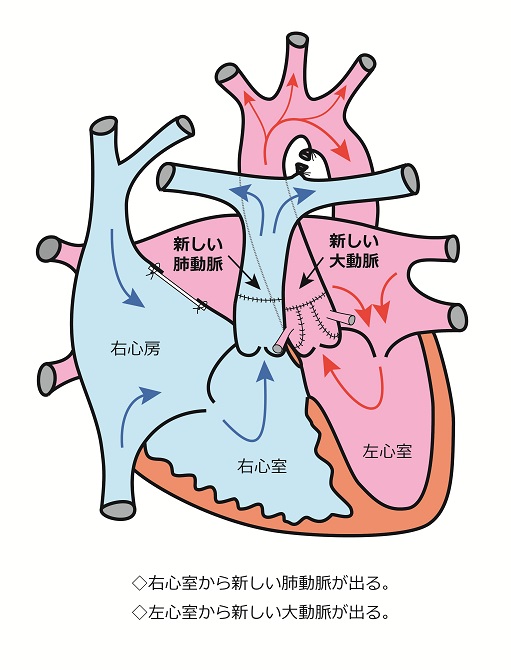 心臓シェーマ