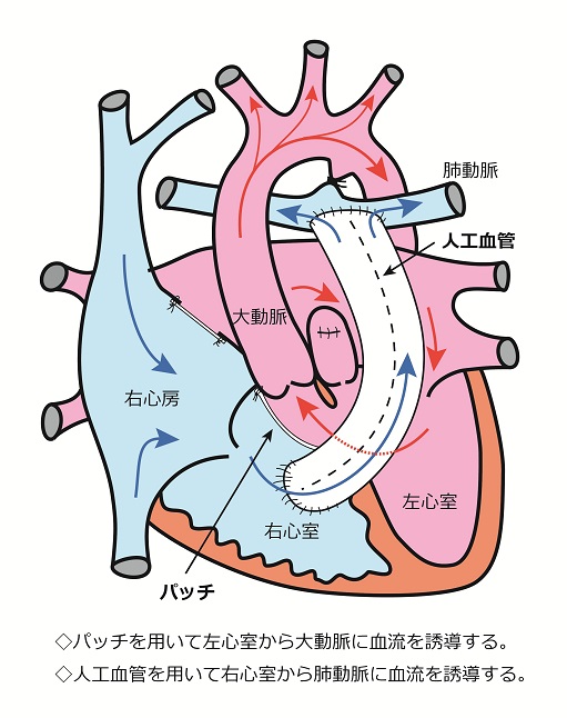 心臓シェーマ