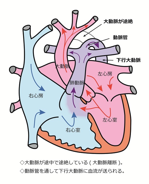 心臓シェーマ