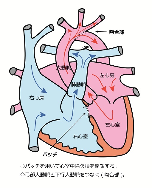 心臓シェーマ