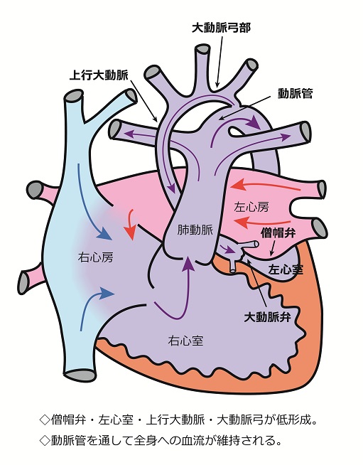 心臓シェーマ