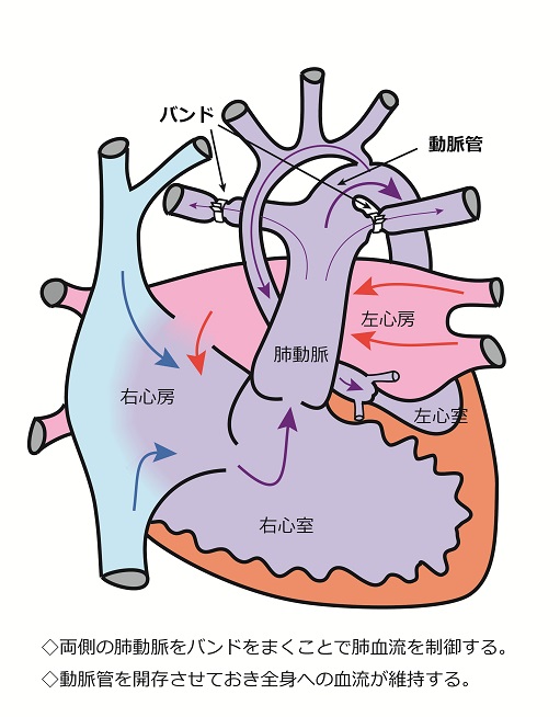 心臓シェーマ