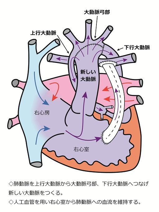 心臓シェーマ