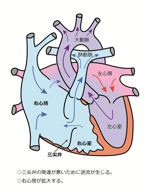 心臓シェーマ