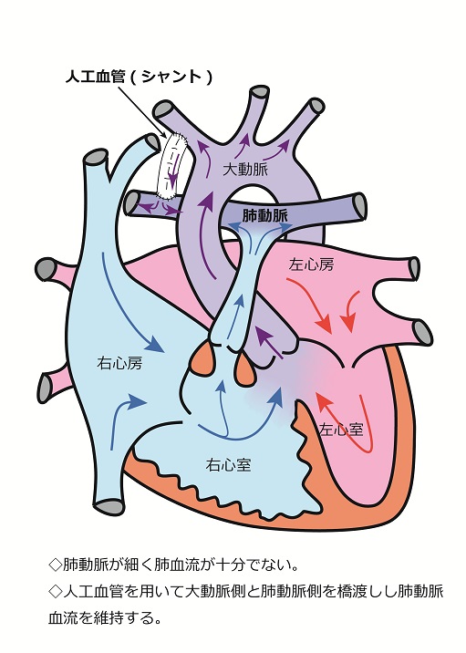 心臓シェーマ
